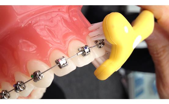 Yellow heart shaped toothbrush brushing braces