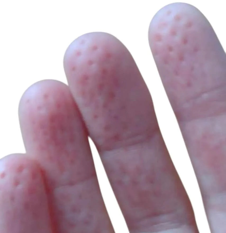 Kaiko Spikeyring with Dual Pads